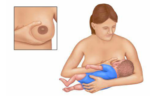 Фигурата показва как да помогнете на бебето да хване зърното