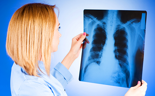 Червеният доктор изследва рентгеново изследване на белите дробове