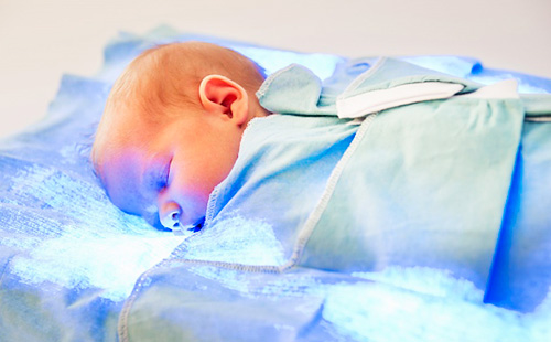 Фототерапия на новородени