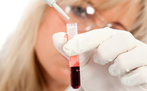 Сестра извършва кръвен тест in vitro