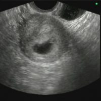 Ембрион близо