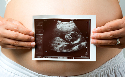 Снимка на ултразвук на фона на бременна корема