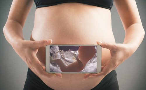 Снимка на бебе в утробата