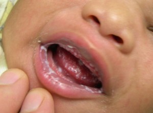 Снимка на млечница в устата на новородено