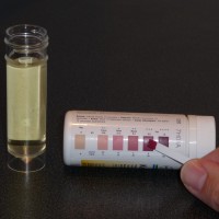 Тест за нивото на ацетона в урината